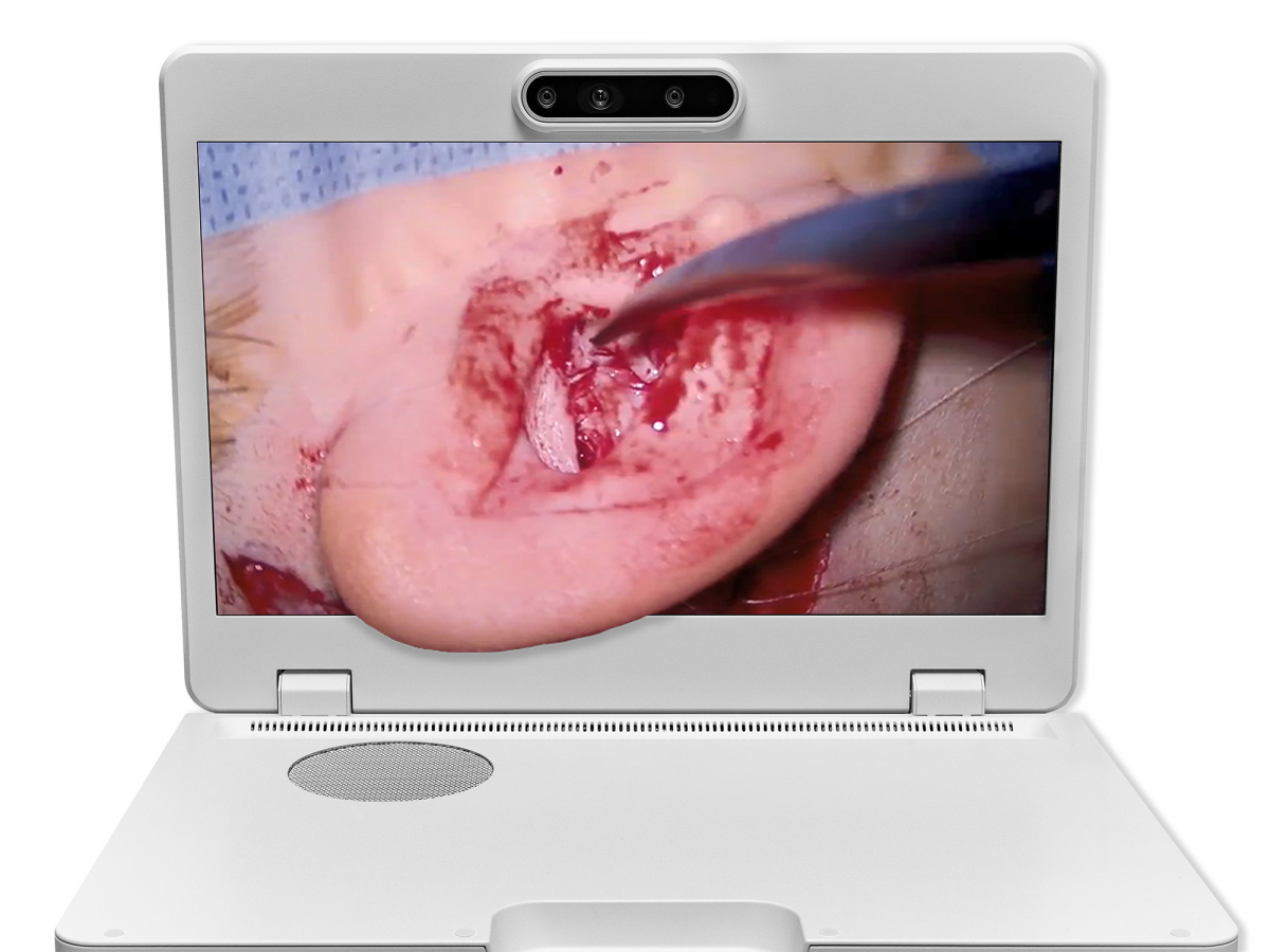 达擎之＂Heads-up 3D显微手术显示系统＂，整合4K裸眼3D显示及眼球追踪系统，具备快速追踪人眼移动位置功能，减轻医师长时间维持固定姿势的负担，让医师能有更宽广清晰的3D立体视野及更舒适的姿势来执行手术。